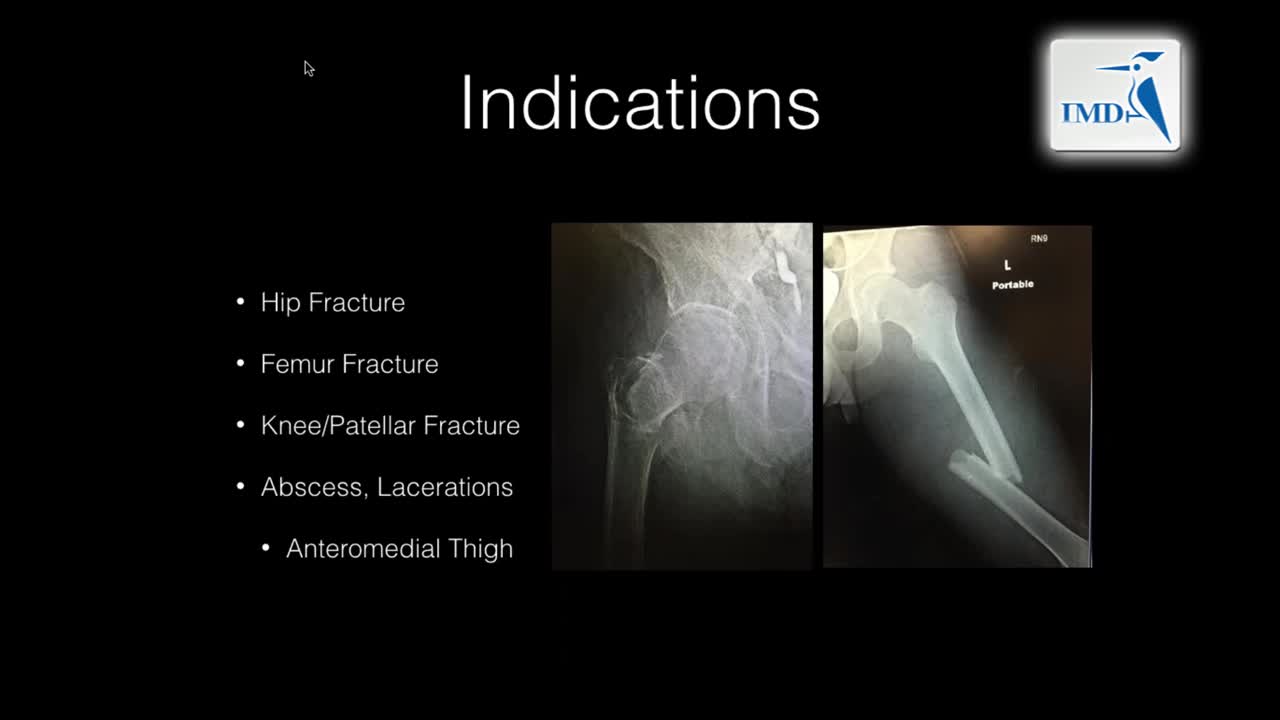02_下肢神经阻滞