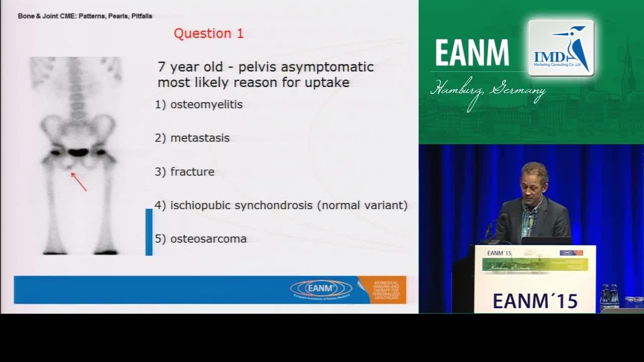 骨骼与关节继续医学教育-误区（1）
