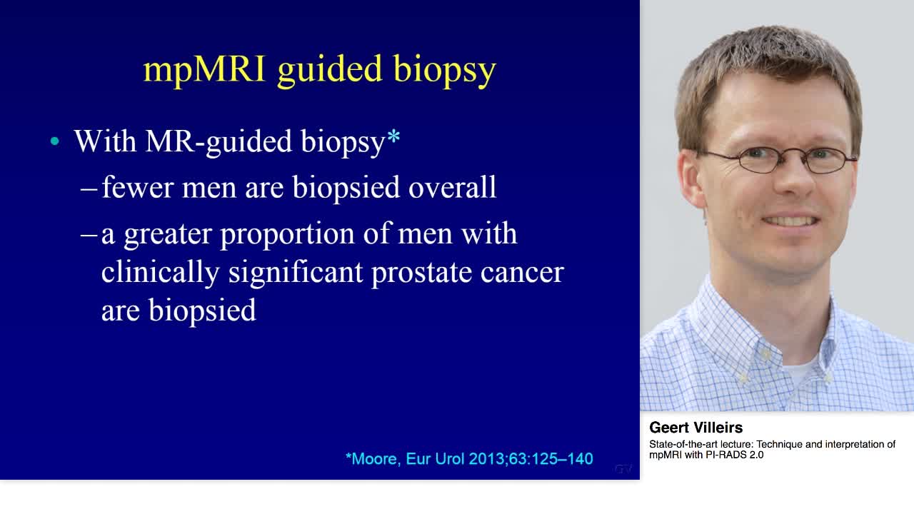 Technique and interpretation of mpMRI with PI-RADS 2.0