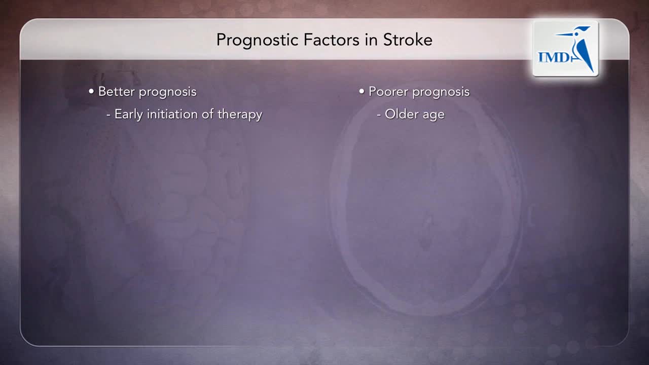 缩短急性缺血性中风入院至溶栓时间会议