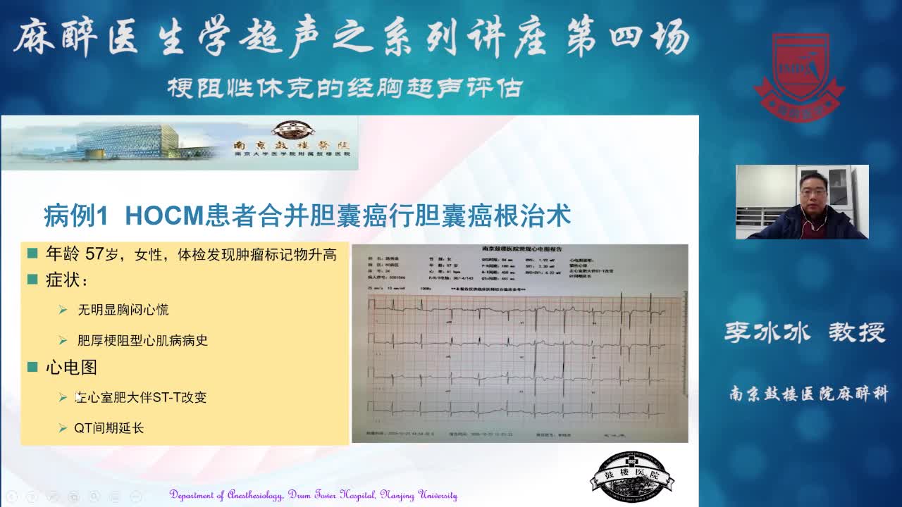 心源性休克的TEE表现及鉴别诊断--李冰冰③