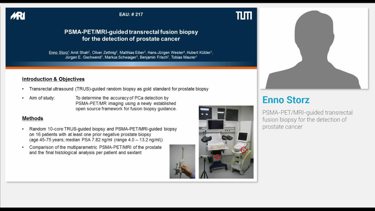 PSMA-PET-MRI-guided transrectal fusion biopsy for the det..-