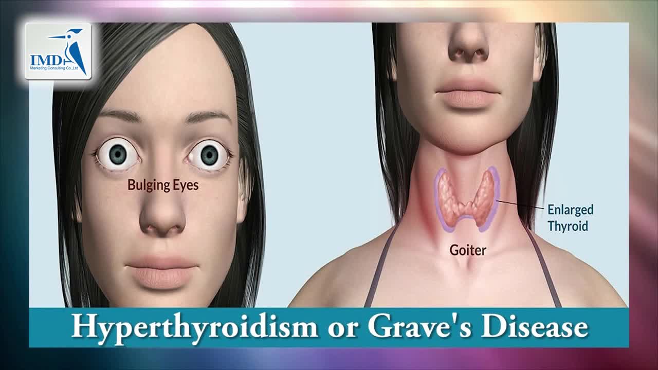 识别甲状腺疾病