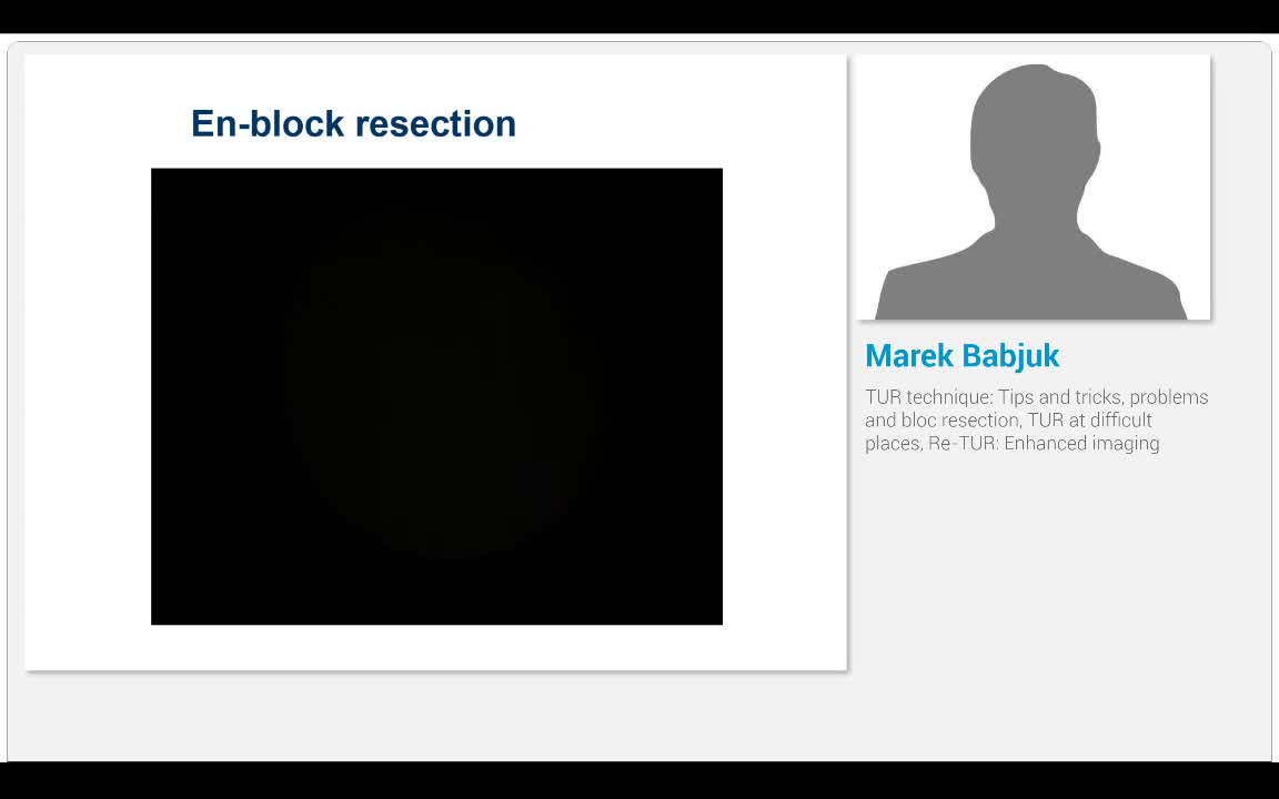 TUR technique, Tips and tricks, problems and bloc resecti..-