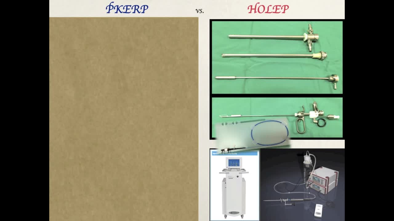 Plasma kinetic enucleation and resection of the prostate ..-