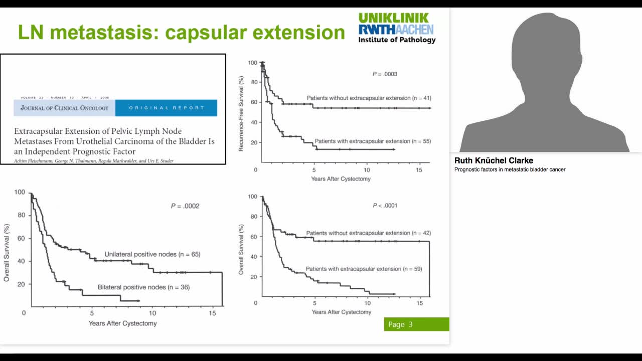 Prognostic factors in metastatic bladder cancer
