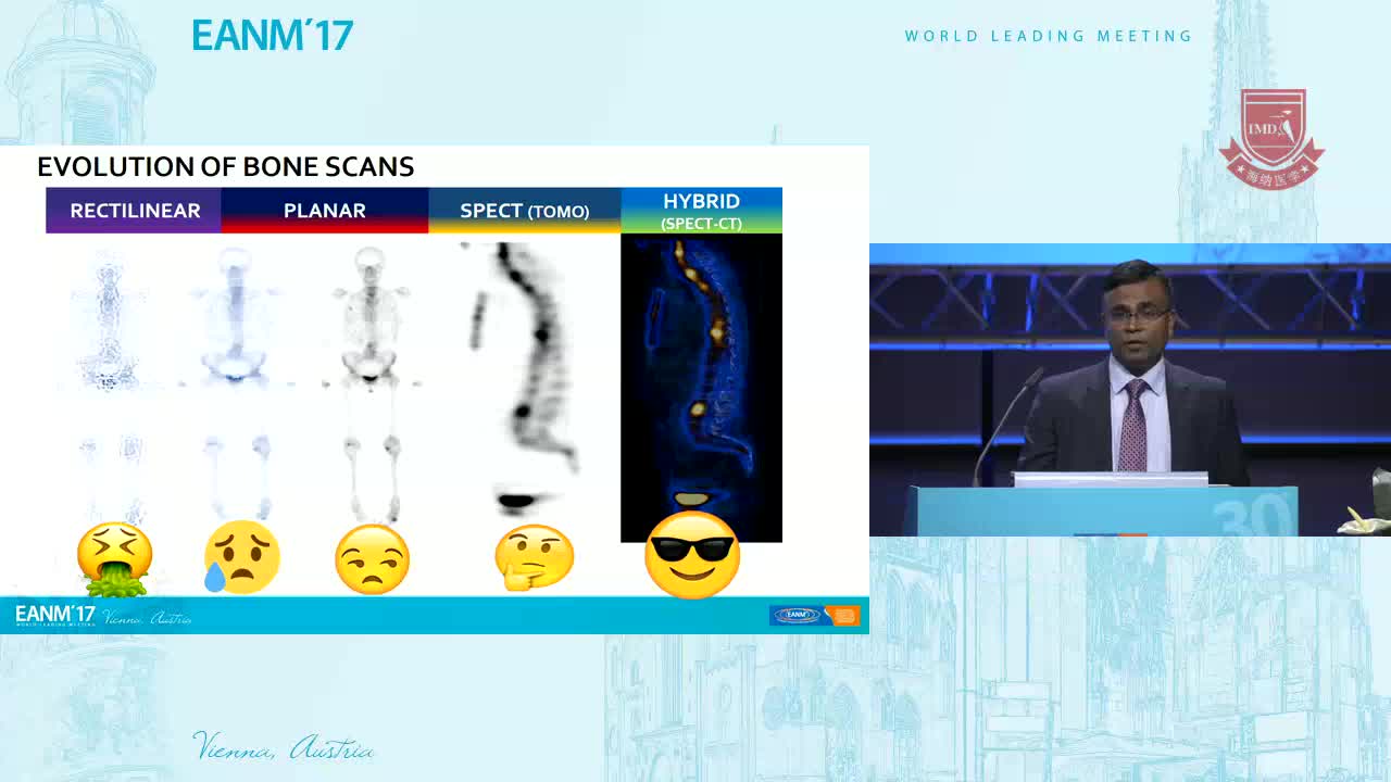 SPECT CT十大诊断1