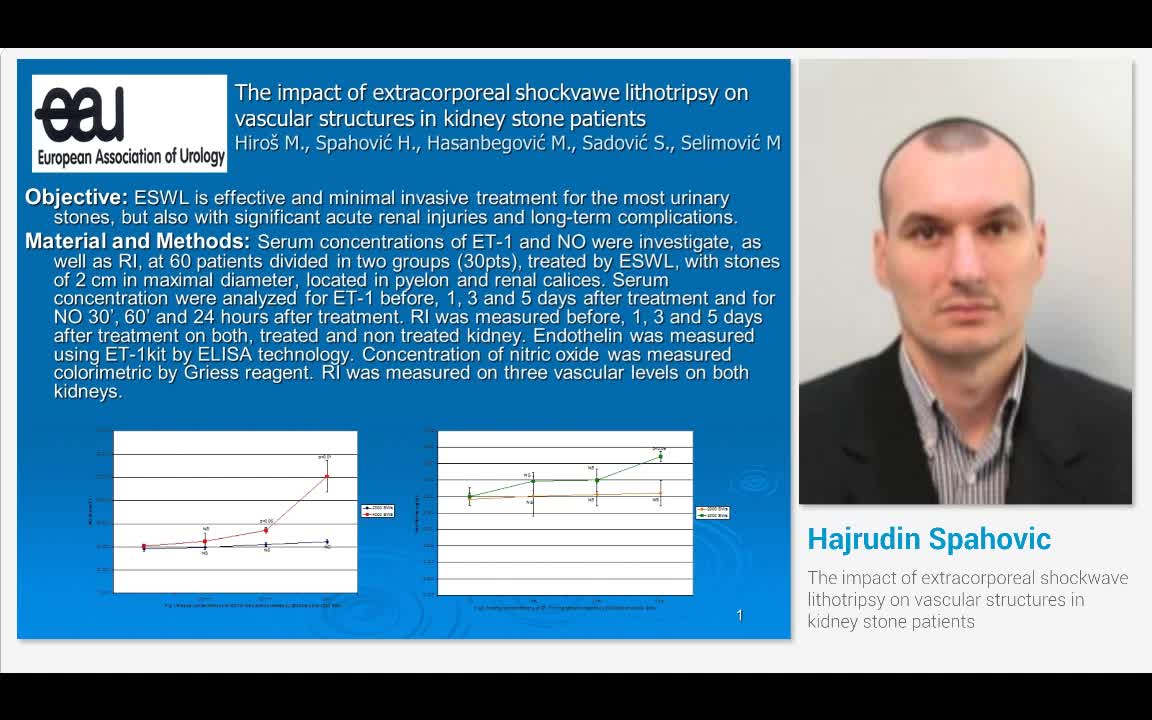 The impact of extracorporeal shockwave lithotripsy on vas..-