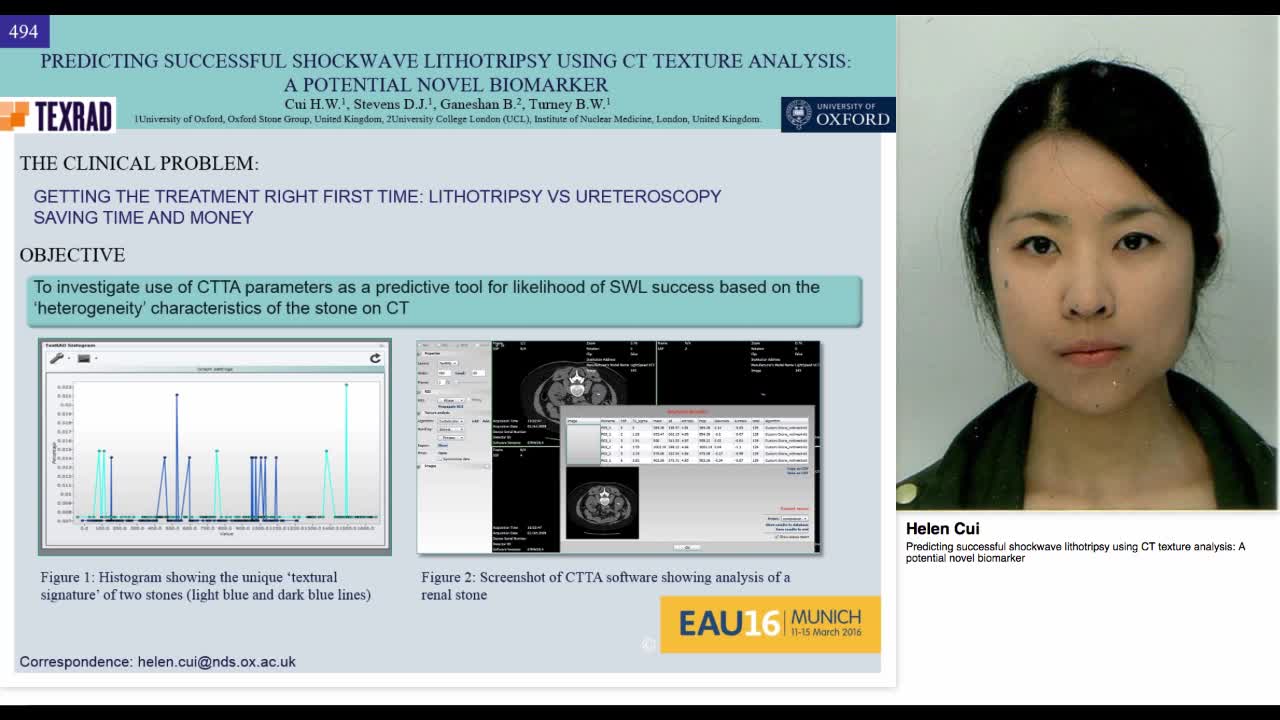 Predicting successful shockwave lithotripsy using CT text-