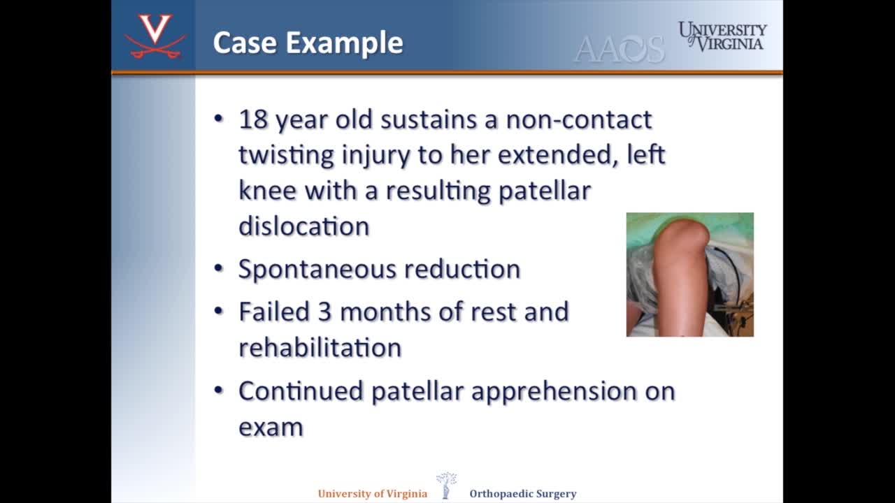 Medial Patellofemoral LigamentReconstruction - Getting it Right