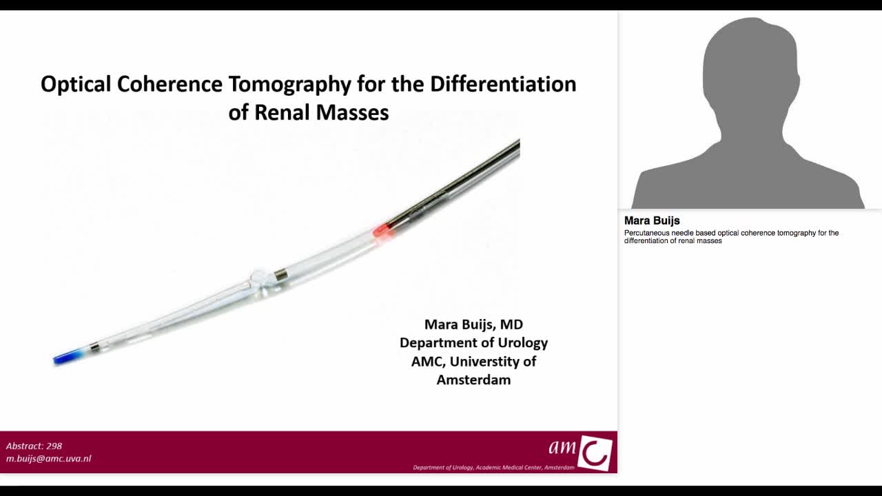 Percutaneous needle based optical coherence tomography fo-