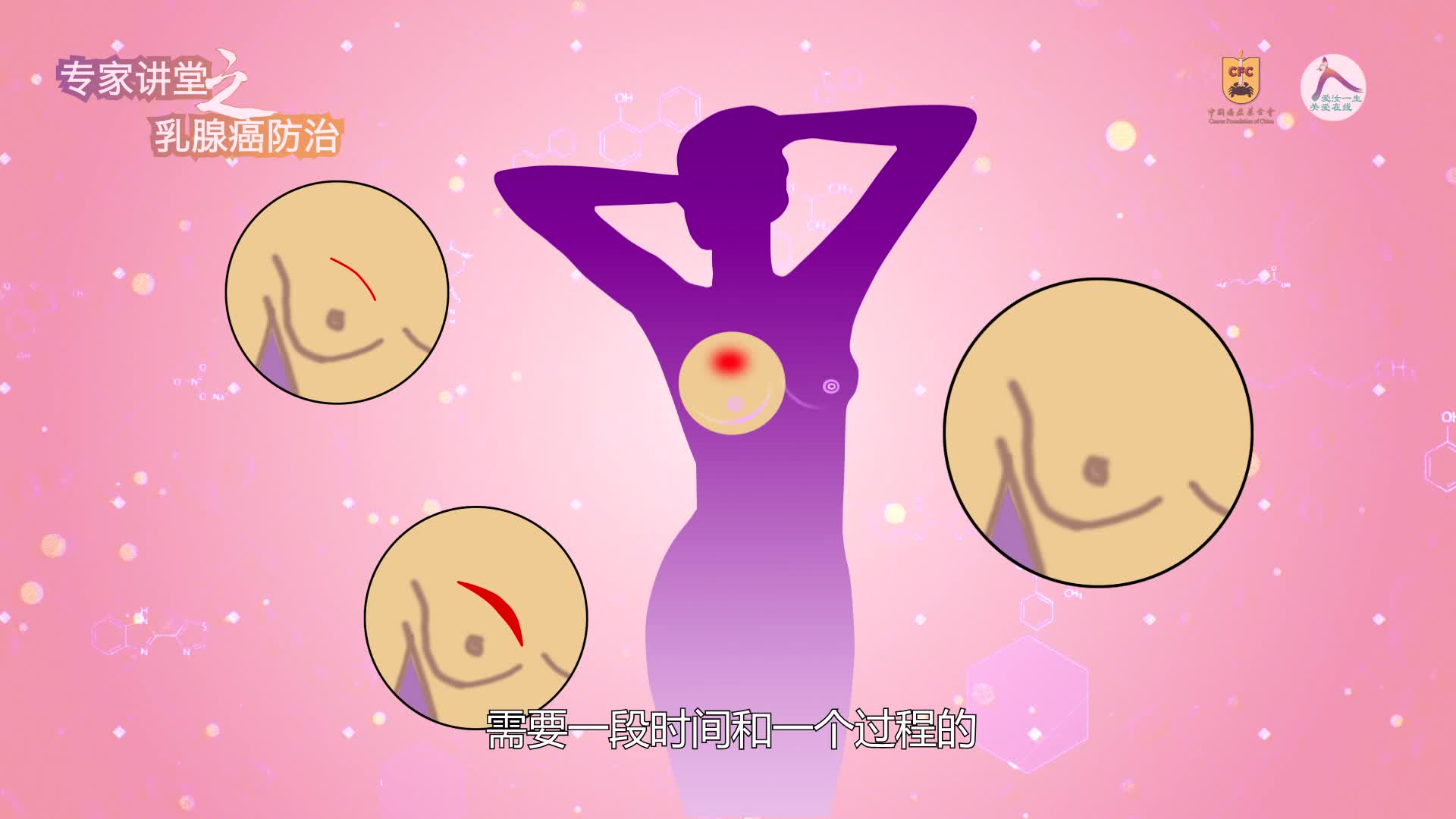 陈文林：乳腺癌术后应注意哪些问题？