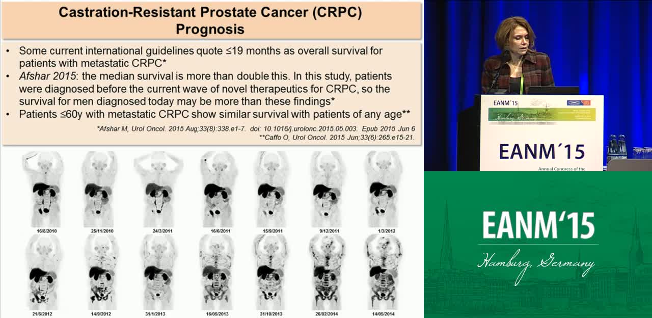 18F-氟胆碱在去势抵抗前列腺癌和其他恶性肿瘤中的作用