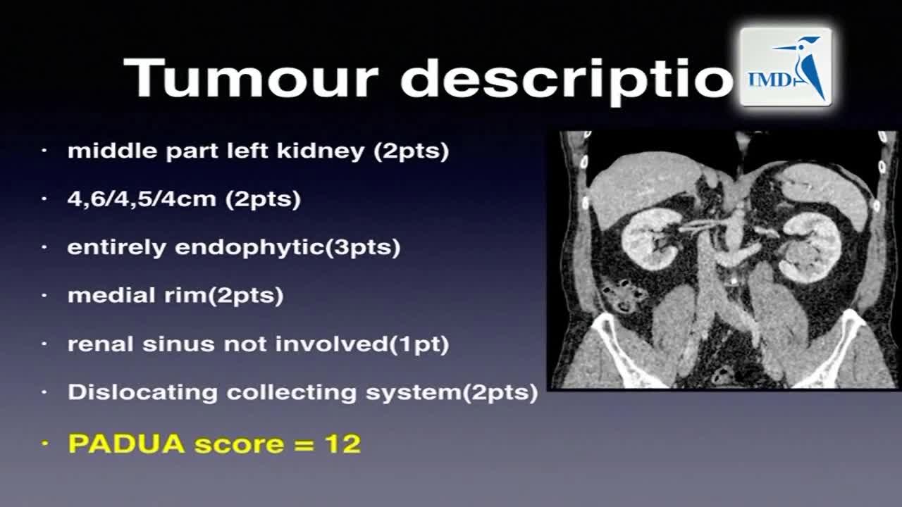 腹腔镜肾部分切除术是否可以应用于肾肿瘤治疗