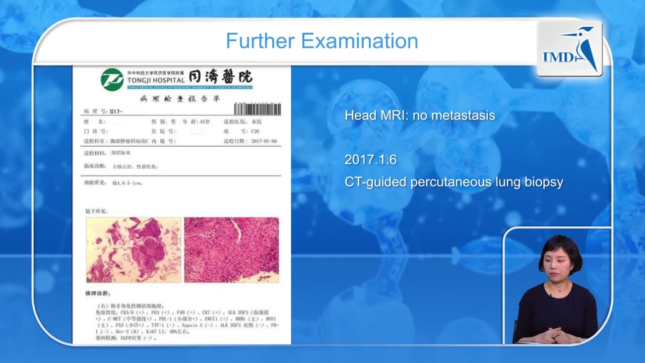 TKI治疗中的一点思考（4）