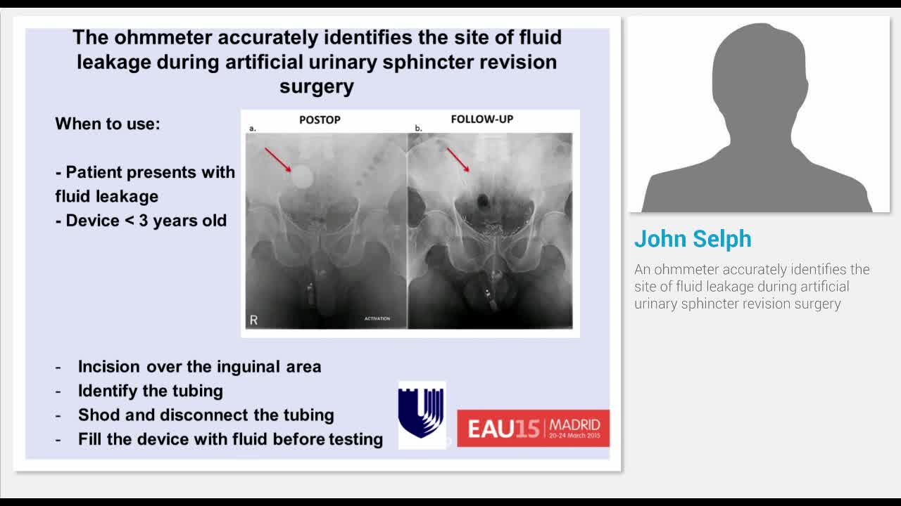 An ohmmeter accurately identifies the site of fluid leaka..-