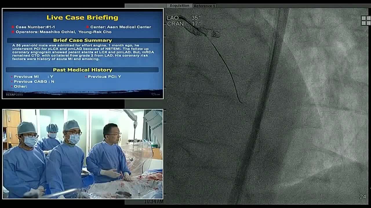 血管内手术现场案例一（1）