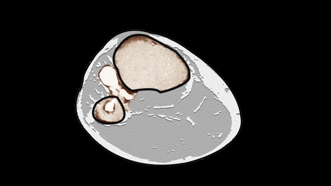 Rizzzoli Orthopaedics Institutes Present