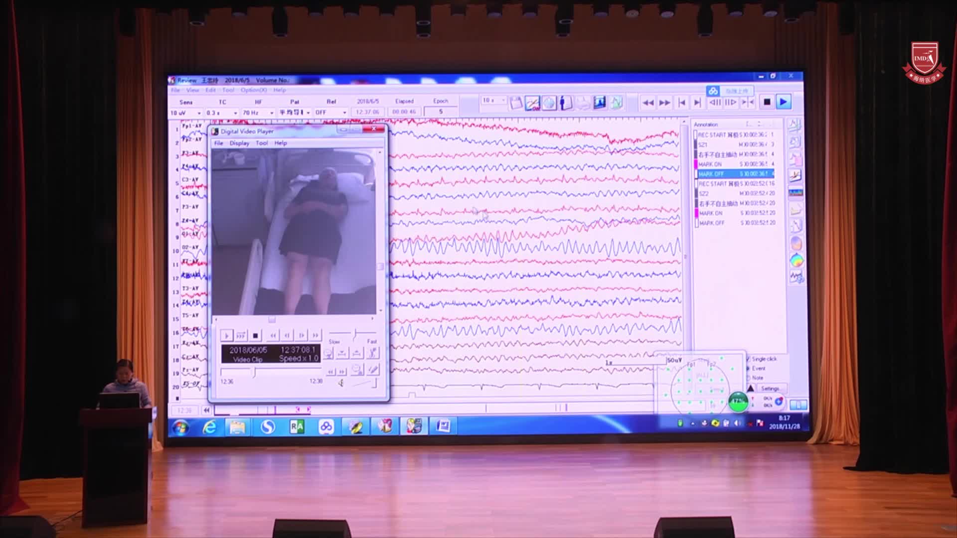 大查房-定位定性诊断（1）7