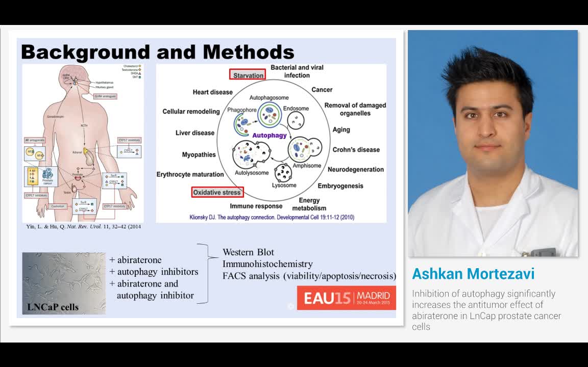 Inhibition of autophagy significantly increases the antit..-