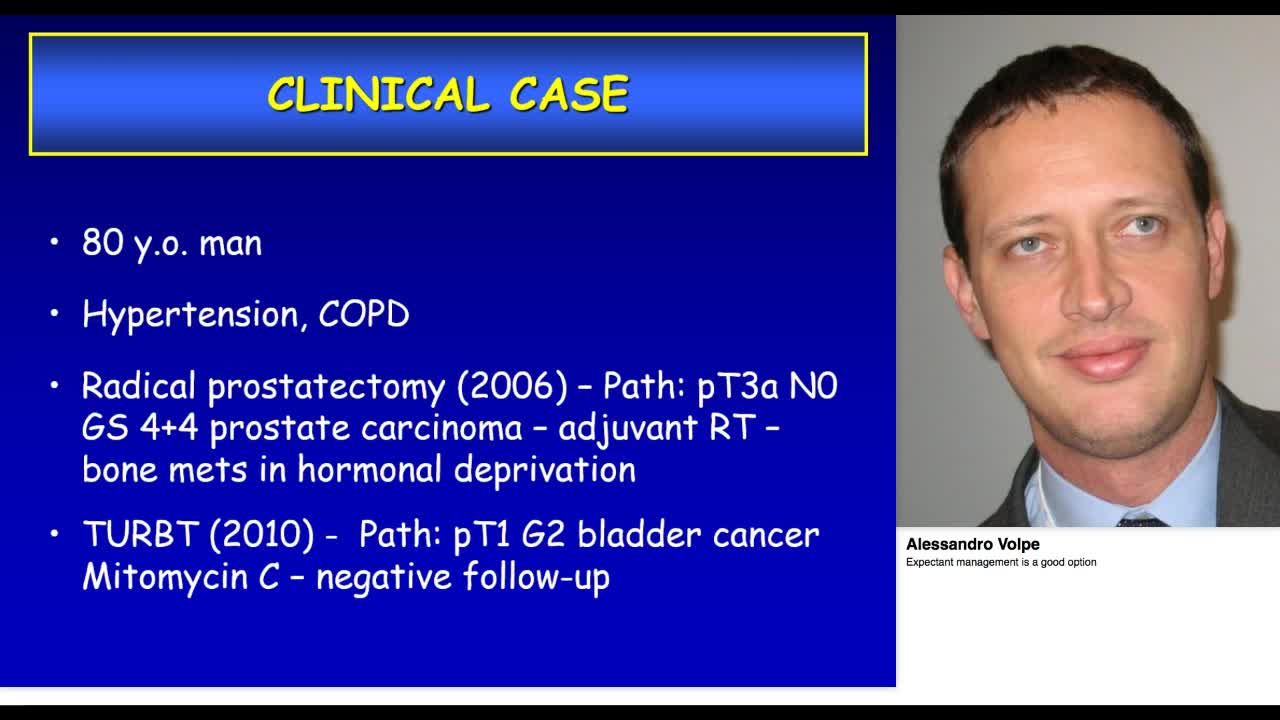 Expectant management is a good option