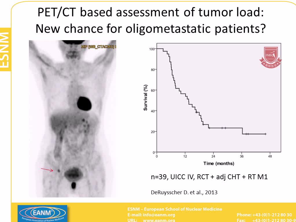 PET CT用于肺癌及其在放射治疗中的应用5