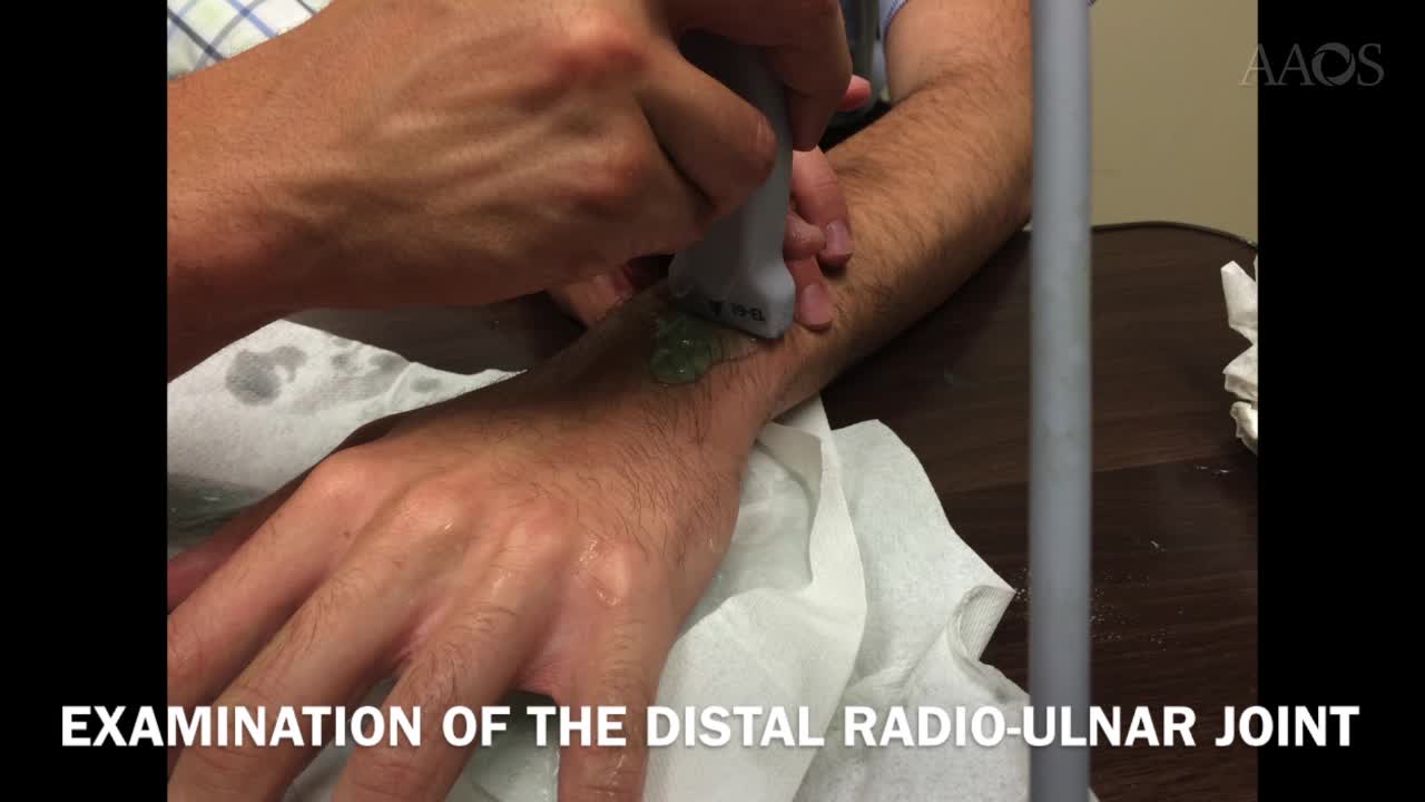 DYNAMIC ULTRASOUND OF THE HAND AND WRIST WITH ANATOMIC CORRELATION