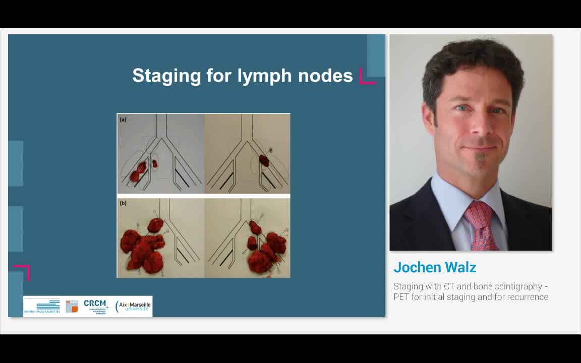Staging with CT and bone scintigraphy - PET for initial s..-