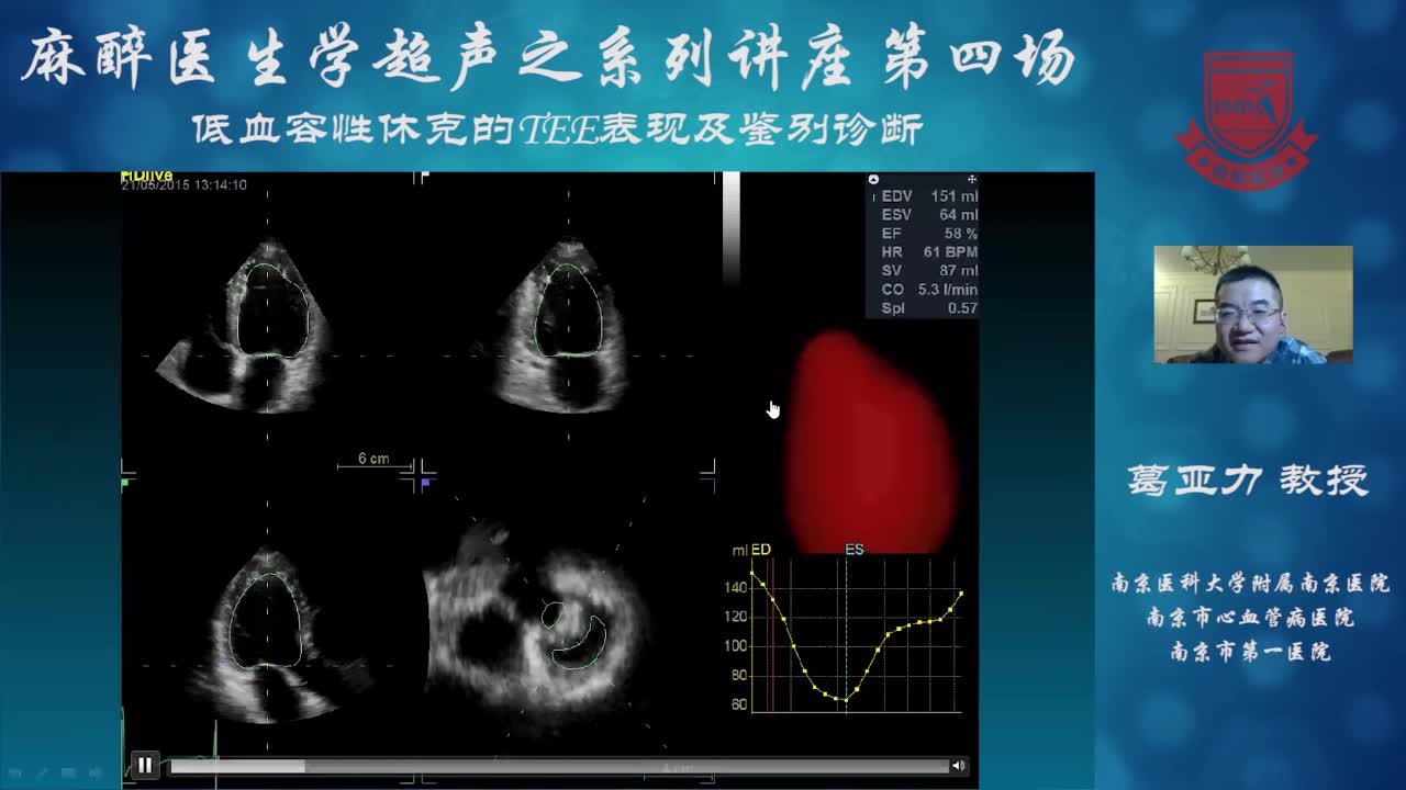 低血容量休克的超声评估--葛亚力③