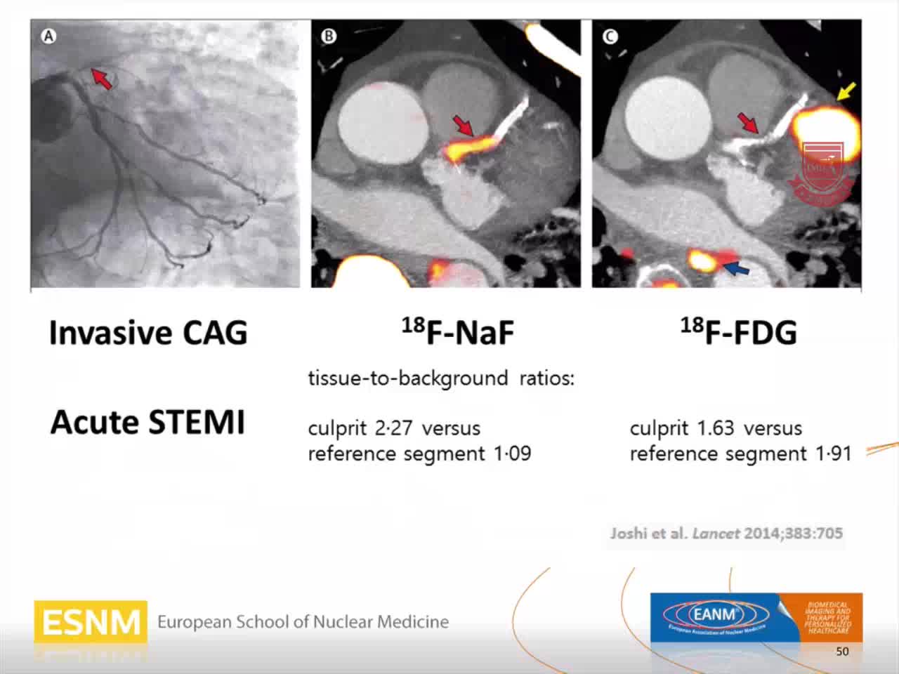 PET CT - 心脏病学的未来发展前景4