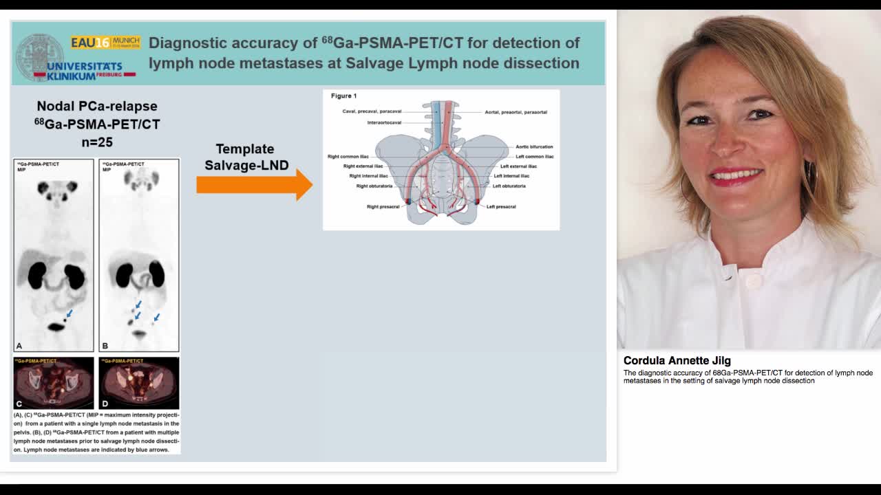 The diagnostic accuracy of 68Ga-PSMA-PET-CT for detection-