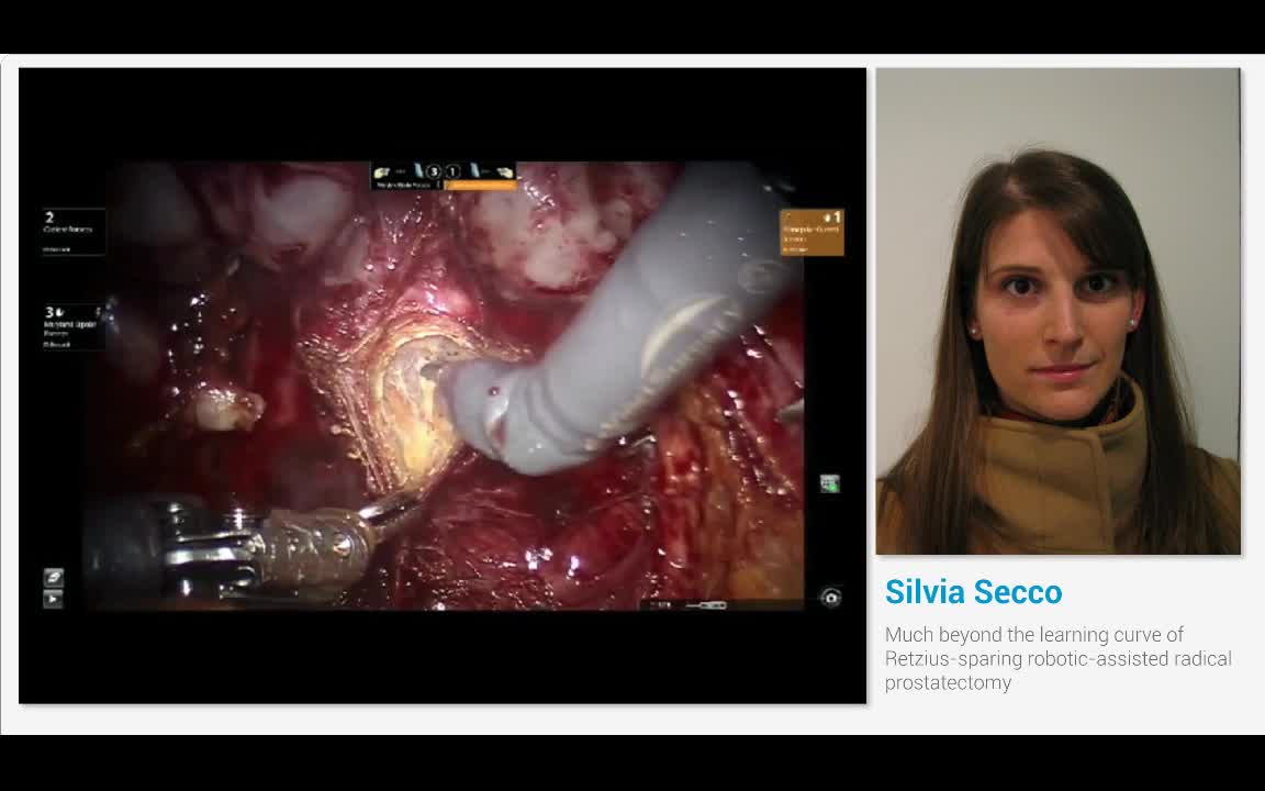 Much beyond the learning curve of Retzius-sparing robotic..-