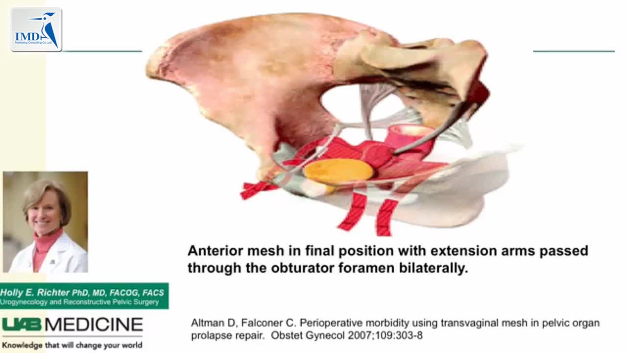盆腔脏器脱垂手术_04
