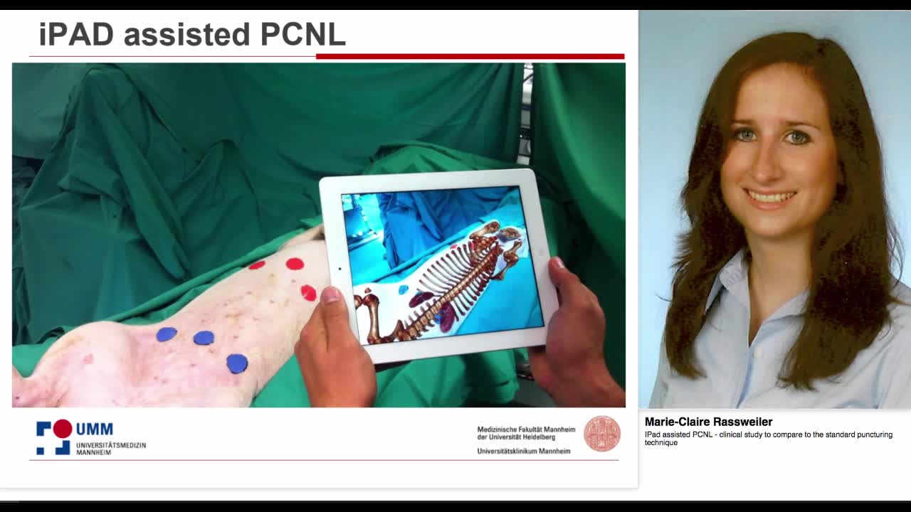 IPad assisted PCNL - clinical study to compare to the sta-