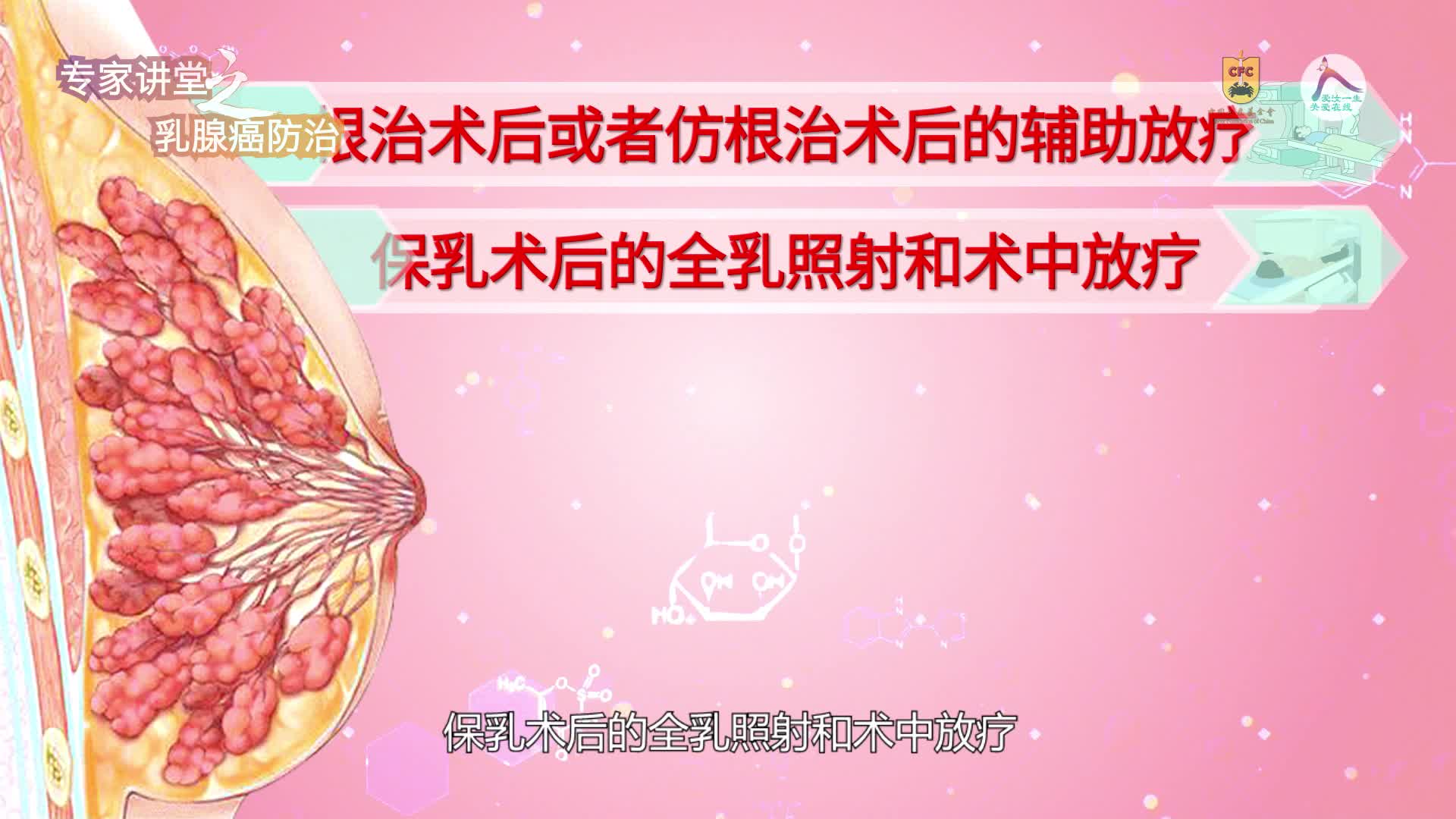 11 彭少华-乳腺癌放射治疗浅谈