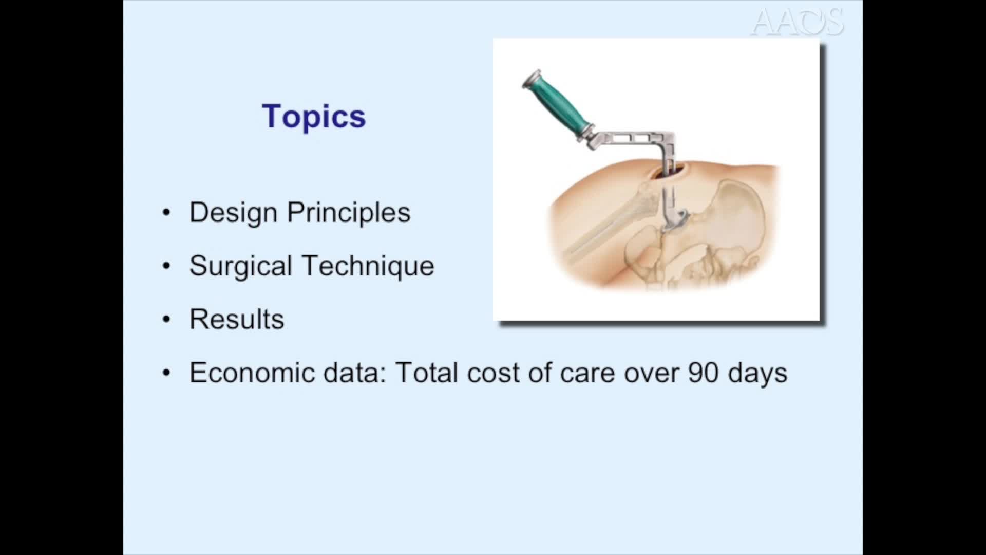 The Superior Approach for Total Hip Arthroplasty 13 year Clinical Experience
