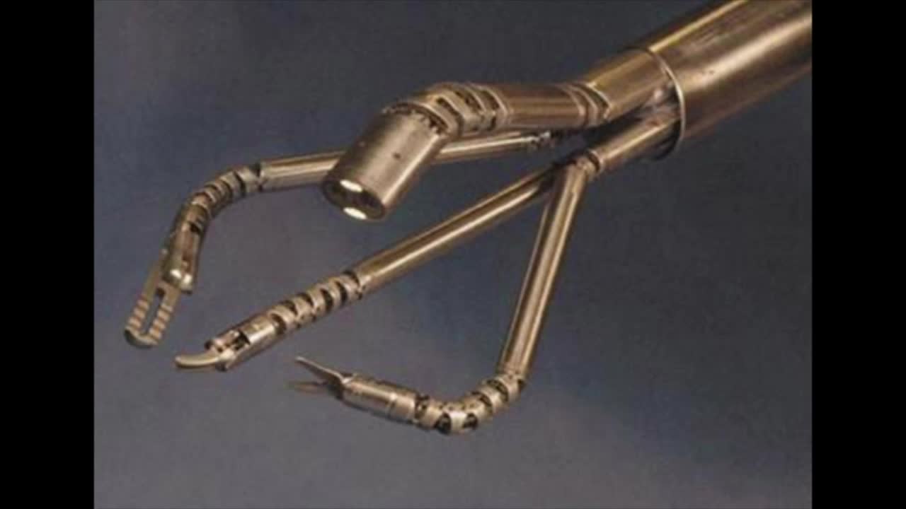 Novel robotic platform for single port partial nephrectomy
