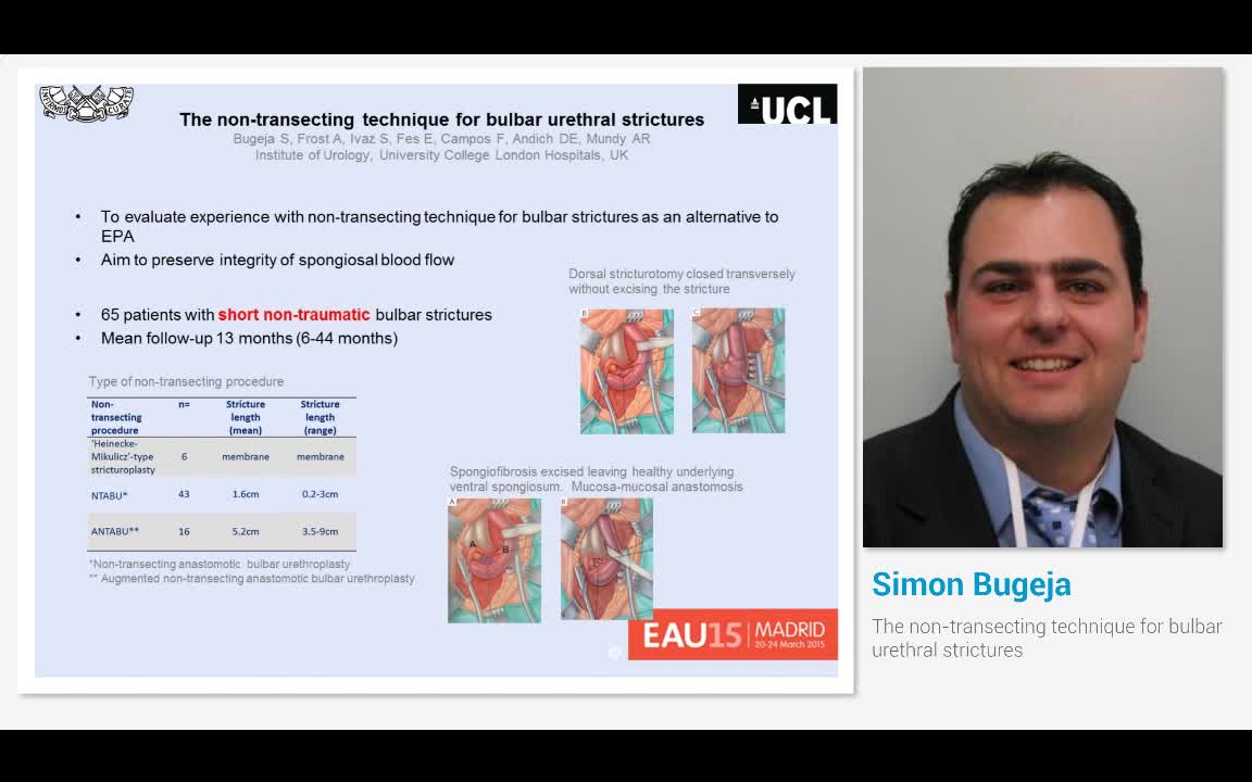 The non-transecting technique for bulbar urethral strictures