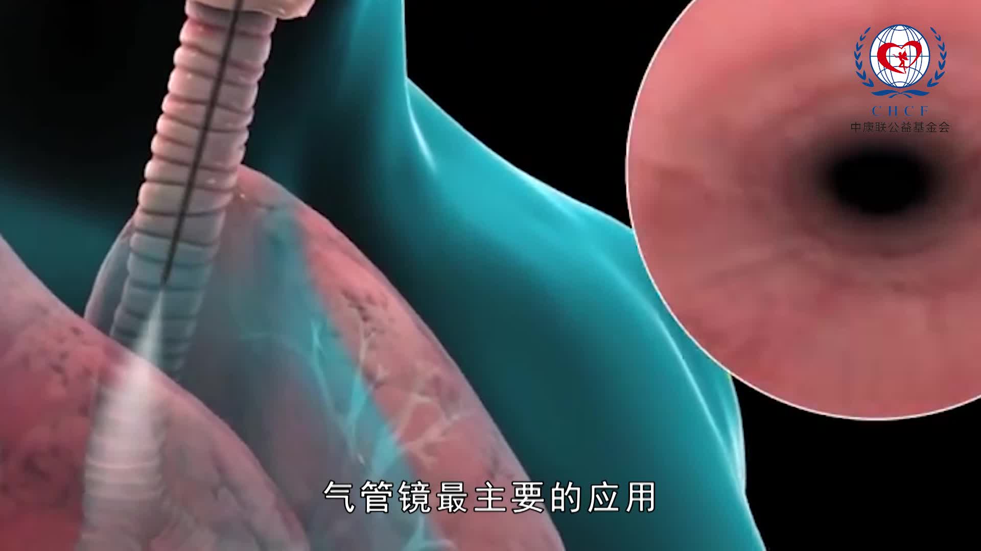 支气管镜检查在肺癌诊治中的作用-孙加源