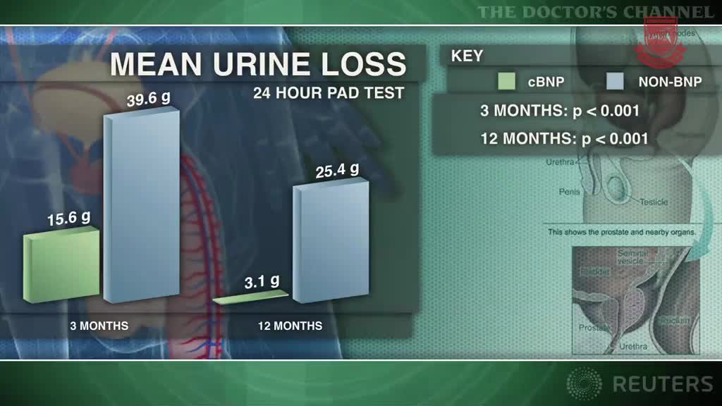 前列腺切除术保留膀胱颈后尿失禁减少
