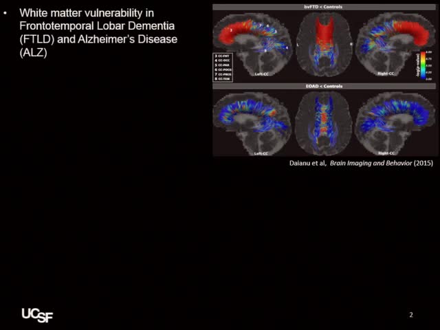 Differential Longitudinal Decline of White Matter Integrity in Frontotemporal Lobar Degeneration and Alzheimer's Disease