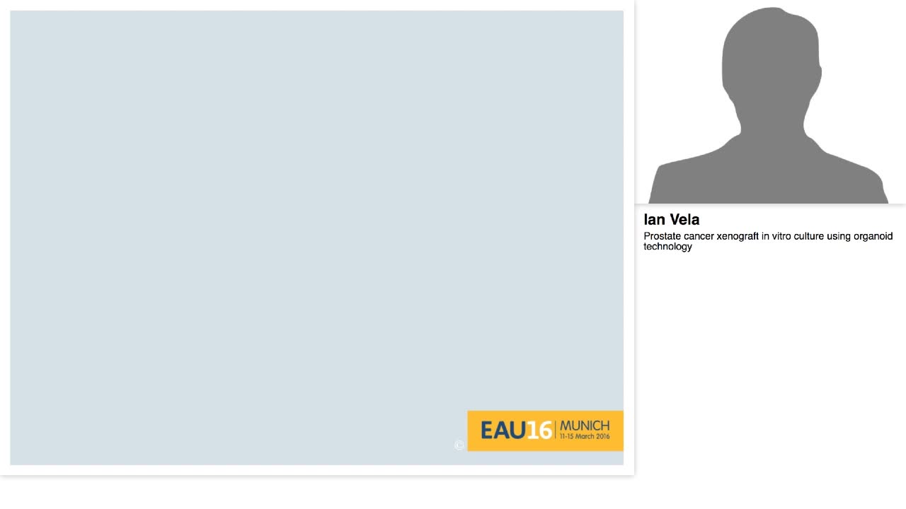 Prostate cancer xenograft in vitro culture using organoid-