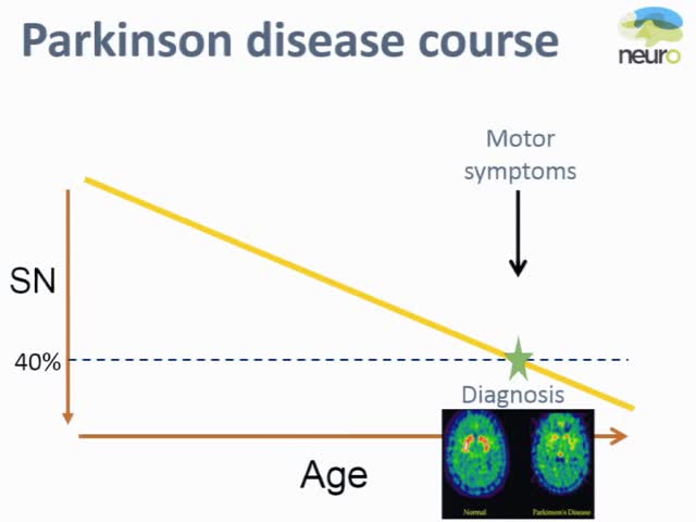 GBA Mutations in REM Sleep Behavior Disorder and Parkinson Disease