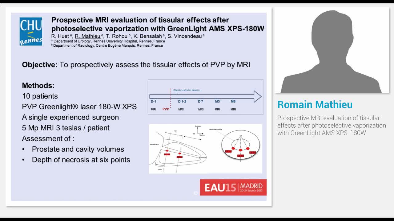 Prospective MRI evaluation of tissular effects after phot..-