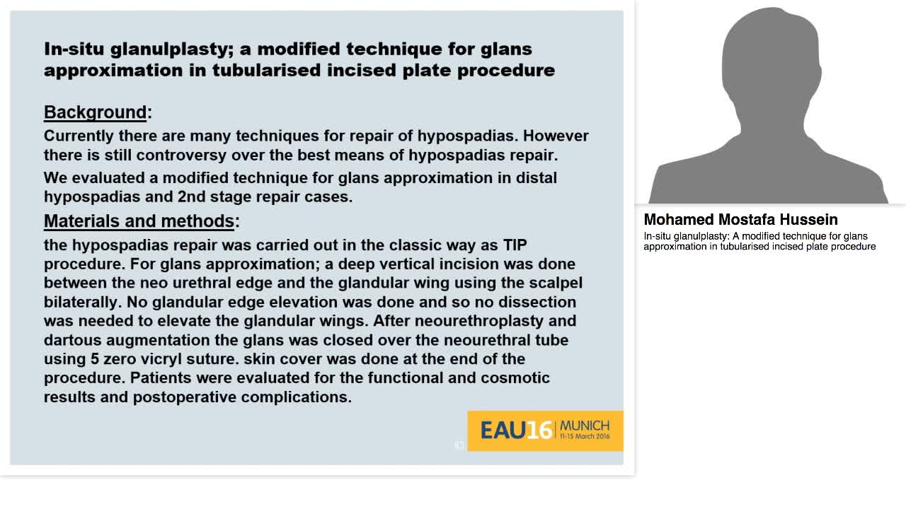In-situ glanulplasty, A modified technique for glans appr-