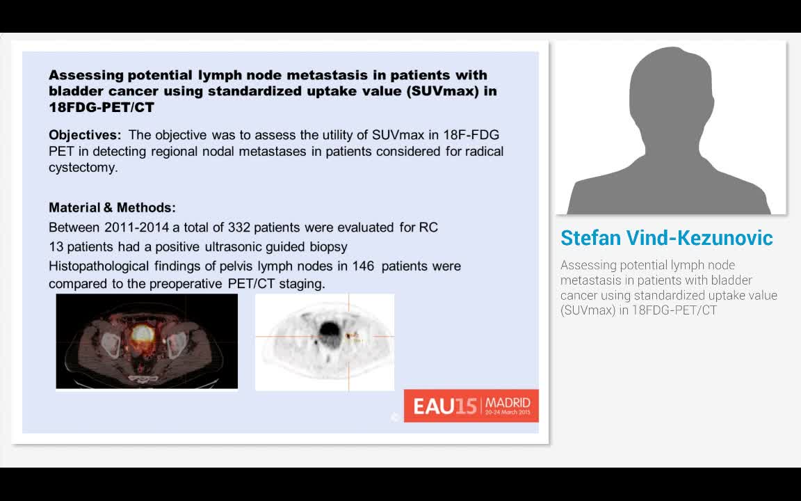 Assessing potential lymph node metastasis in patients wit..-