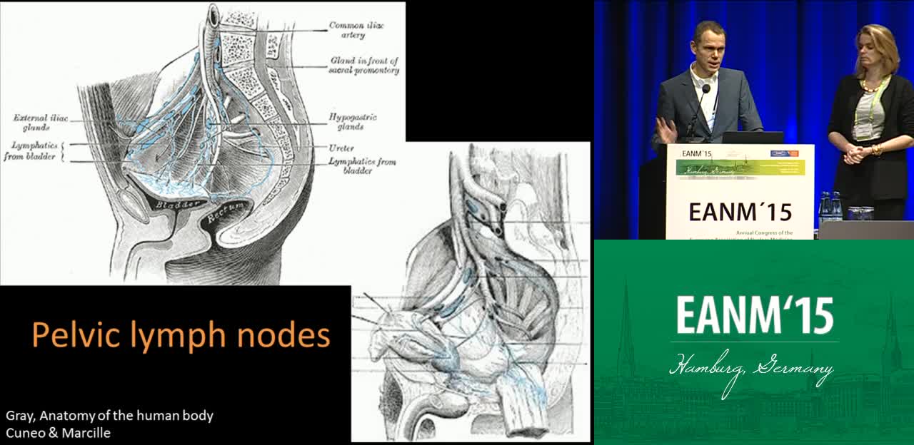 机器人辅助腹腔镜前哨淋巴结手术中的联合放射和荧光引导