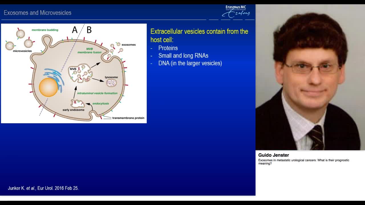 Exosomes in metastatic urological cancers, What is their -