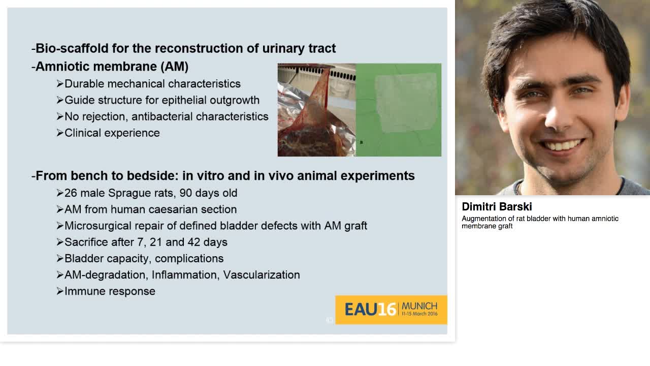 Augmentation of rat bladder with human amniotic membrane -