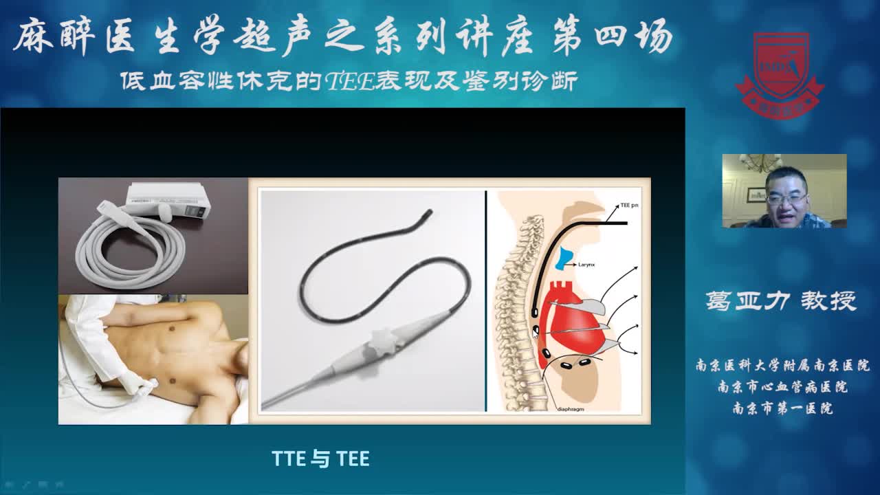 低血容量休克的超声评估--葛亚力②